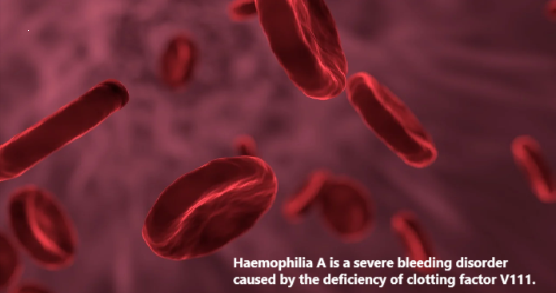 Groundbreaking Gene Therapy Revolutionizes Haemophilia A Treatment