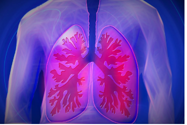  Chronic obstructive pulmonary disease (COPD)